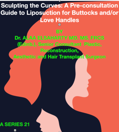 liposuction for buttocks and/or love handles